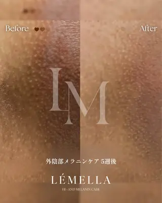 BLESS BEAUTYのエステ・リラクイメージ