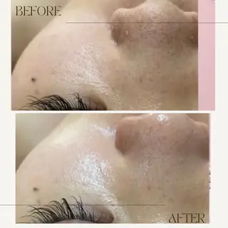 ニキビ毛穴専門店Beautysalon Luana所属・小林 まいのエステ・リラクイメージ