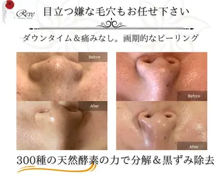 堀井 舞琳のエステ・リラクイメージ