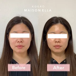 小顔　MAISON ELLAのエステ・リラクイメージ