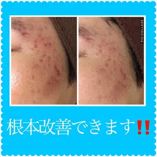 ミディアム カラー パーマ ヘアアレンジ メンズ キッズ ネイル マツエク・マツパ ニキビ・肌質改善専門 ♡人生が変わるサロンのエステ・リラクイメージ