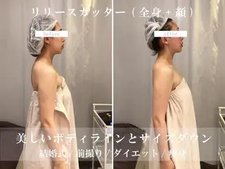 ブライダルサロン ｜Lino【堀江】のエステ・リラクイメージ