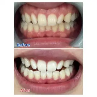 M渋谷店所属・Ｍ渋谷 ホワイトニングのエステ・リラクイメージ