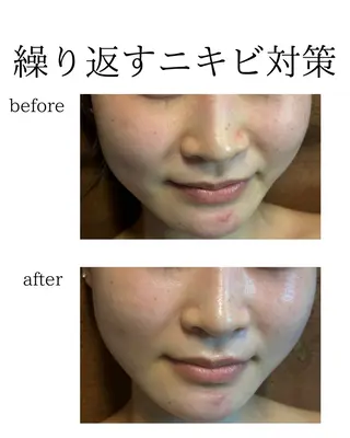 Salon【yuzu.】所属・🍊肌管理×美眉 【yuzu.】の眉毛・アイブロウイメージ