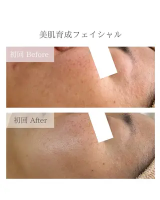 美肌育成専門サロンラクシュミー所属・毛穴肌管理サロン ラクシュミーのエステ・リラクイメージ