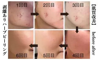 NHerb【エヌハーブ】所属・横田 汐里のエステ・リラクイメージ