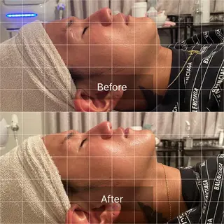 脱毛＆痩身サロン LivLivのエステ・リラクイメージ