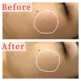 ハーブピーリング専門 muro.のエステ・リラクイメージ