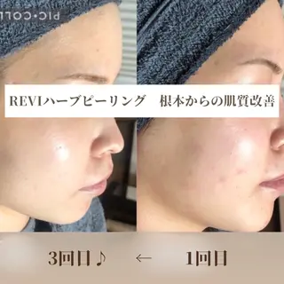 KREIE所属・KREIE クレイエ 仙台市太白区エステのエステ・リラクイメージ