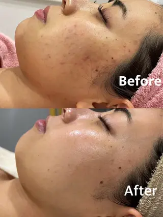 産後/ツヤ肌/子連れ /保育士在籍サロンのエステ・リラクイメージ