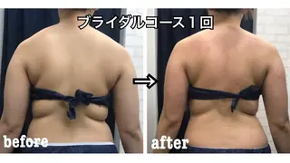 アイトータル ビューティーのエステ・リラクイメージ