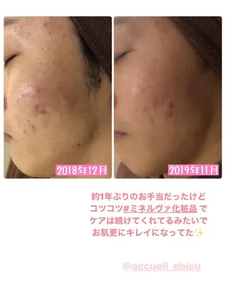 ミディアム カラー パーマ ヘアアレンジ メンズ キッズ ネイル マツエク・マツパ ニキビ・肌質改善専門 ♡人生が変わるサロンのエステ・リラクイメージ