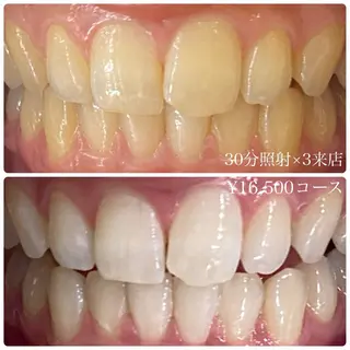 PLATINUM Beauty 横浜店所属・ホワイトニングルーム 横浜店のその他イメージ