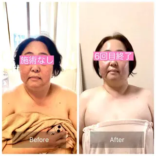 小顔&ヘッドスパ haruhandのエステ・リラクイメージ