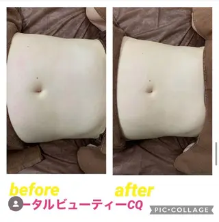 トータルビューティー CQのネイルデザイン