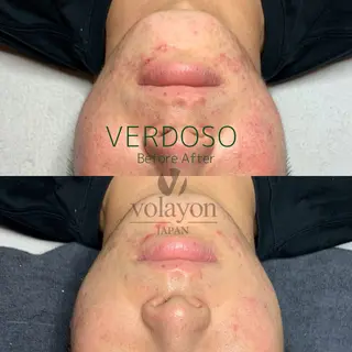 韓国風eyelush 眉毛サロン/Suuの眉毛・アイブロウイメージ