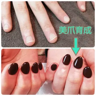 ネイル 深爪矯正/爪育成ケア manie nailのネイルデザイン