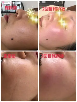 エステティシャン SAORIのエステ・リラクイメージ