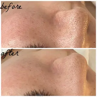 メンズ メナード岐阜市茜部 杉浦のエステ・リラクイメージ