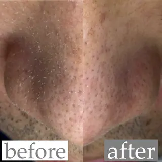 毛穴専門サロン ライカブルーのエステ・リラクイメージ