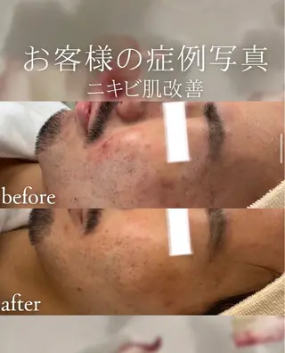 メンズ cpsalon ÉTOILE横浜馬車道店所属・ÉTOILE NATSUMIのエステ・リラクイメージ