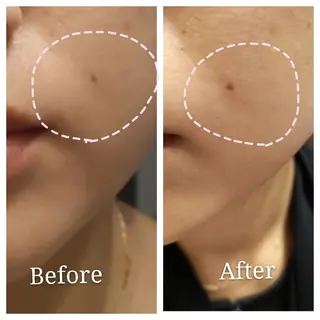 🅖🅤🅩🅔🅛 salonのエステ・リラクイメージ