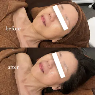 NOEL所属・フェイシャルエステ Utaiのエステ・リラクイメージ