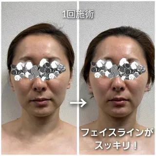 シミ・たるみ専門 サロン Cherieのエステ・リラクイメージ