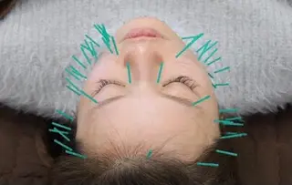 美容鍼サロン    Fleurir所属・伊藤 かなえのエステ・リラクイメージ