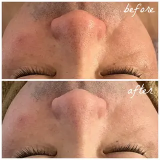 メンズ メナード岐阜茜部 杉浦のエステ・リラクイメージ