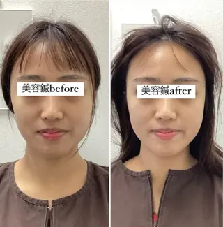 hari salon de off 美容鍼灸×小顔整体【ハリサロンドオフ】所属・美容鍼灸×小顔整体♡ ハリサロンドオフ堺東のエステ・リラクイメージ