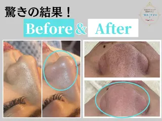 部分痩せ♥️小顔専門 MIKUのエステ・リラクイメージ