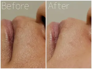 毛穴/肌管理/痩身/ ボディケア/satoのエステ・リラクイメージ