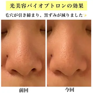 Bellesthe （ベルエステ）のエステ・リラクイメージ