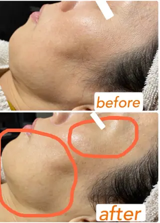 小顔・毛穴・たるみ ネイル　似内真樹のエステ・リラクイメージ