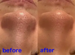 Fulala 永田のエステ・リラクイメージ