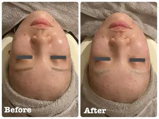 じょう なつみのエステ・リラクイメージ