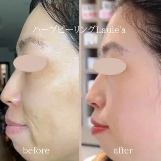 美腸サロン🌺 腸もみ/小顔/リンパのエステ・リラクイメージ