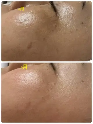 Lien オーナー 山口智嘉のエステ・リラクイメージ