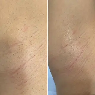 リーズナブル光脱毛サロンOhana所属・永吉 ゆかりのエステ・リラクイメージ