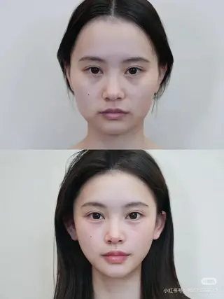 マツエク・マツパ aliaハイフ&水光ジェットサロン所属・aliaハーブ水光店 エステティシャン募集のエステ・リラクイメージ