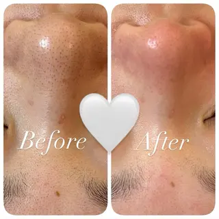 uni. beautyのエステ・リラクイメージ