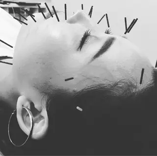 鍼灸整体院　蕾所属・美容鍼 蕾【谷町六丁目】のエステ・リラクイメージ