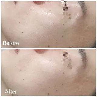 肌質改善Beauty salon Renのエステ・リラクイメージ