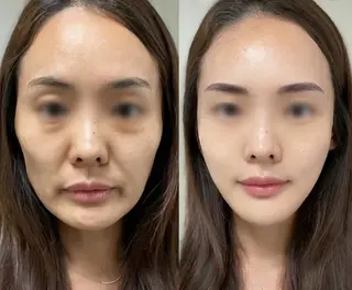 ネイル aliaハイフ&水光ジェットサロン所属・aliaハーブ水光店 エステティシャン募集のエステ・リラクイメージ