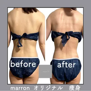 marron所属・痩身ハイパーナイフ ララピールリアボーテのエステ・リラクイメージ