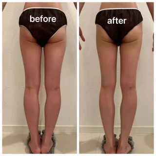 トータルビューティ サロンstageのエステ・リラクイメージ