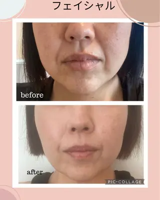 深層リンパドレナージュ ＆産前産後マッサージサロンShe所属・リンパドレナージュ＆ 産前産後サロンSheのエステ・リラクイメージ