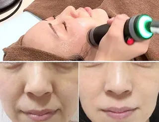 顔脱毛＆毛穴＆ニキビ 優良№1♪ヒロコ♪のエステ・リラクイメージ