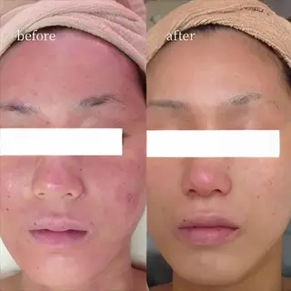 韓国肌管理・肌質改善 EARNEST心斎橋のエステ・リラクイメージ